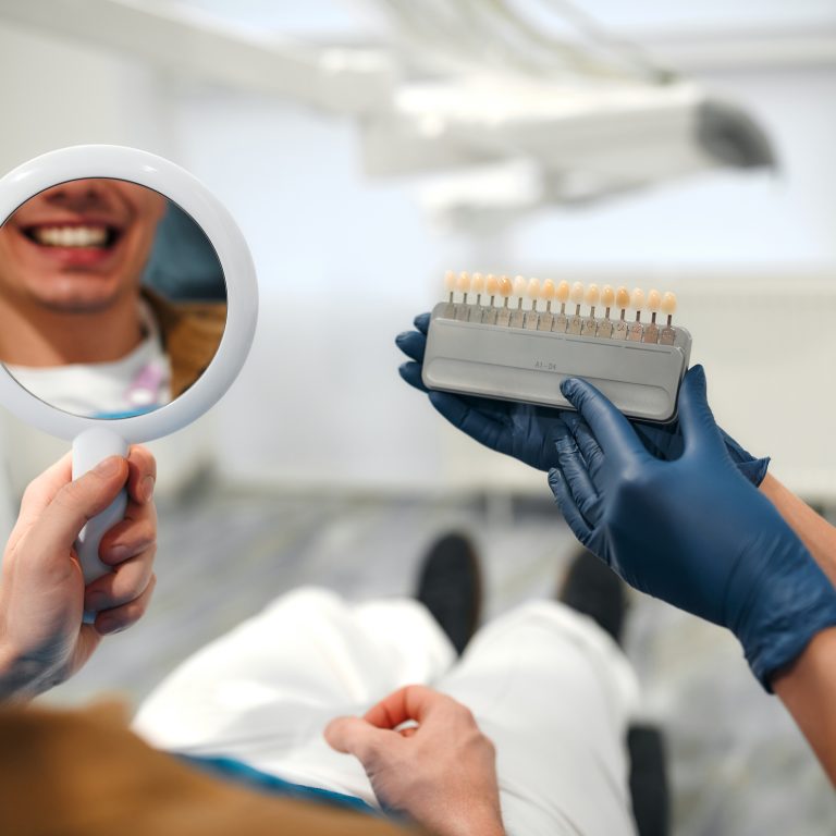 Medicine, dentistry and healthcare concept - closeup of a dentist with tooth color samples choosing a shade for a male patient's teeth in a dental clinic looking at a mirror.